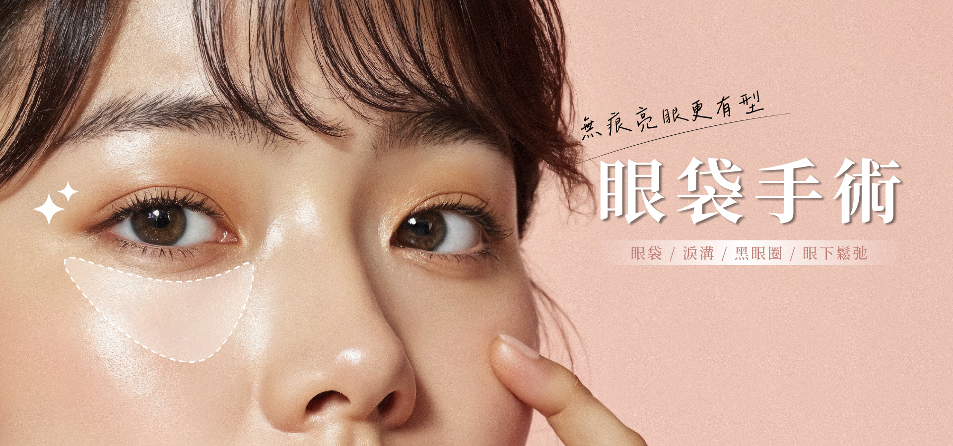 眼袋手術